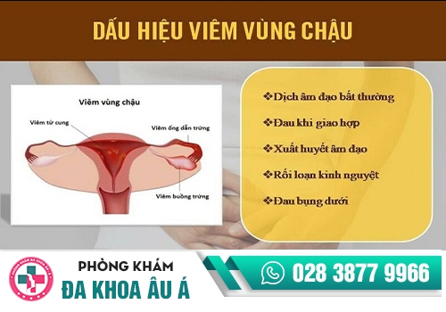 ÂM ĐẠO BỊ HÔI